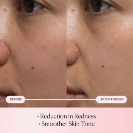 Sérum visage Elemis