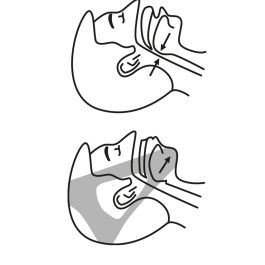 Bande Anti-ronflements Stosnore InnovaGoods