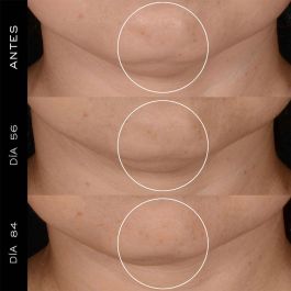 Lancôme Rénérgie Hpn Recharge Crème 300 Peptides 50 Ml