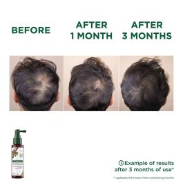 Klorane Sérum Anti-Chute Quinine & Edelweiss Bio - Fortifie et Stimule la Croissance des Cheveux - 100 ml