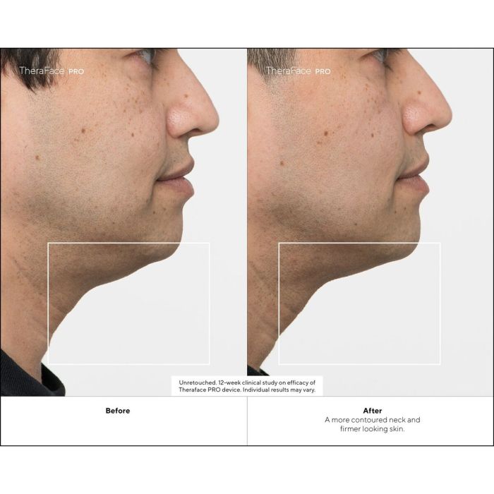 Coffret cadeau Therabody TF02226-01 Noir (1 Unité) 10