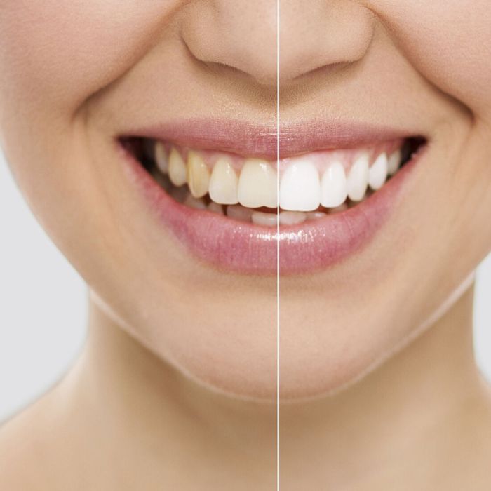 Bandes de Blanchiment Dentaire Wripes InnovaGoods 8