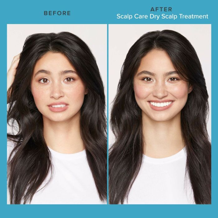 Masque pour cheveux Living Proof Scalp Care 100 ml 2