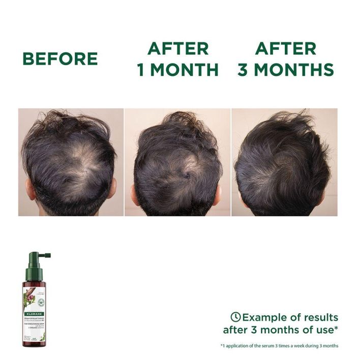 Klorane Quinine Et Edelweiss Bio Sérum Chute De Cheveux 100 mL 1