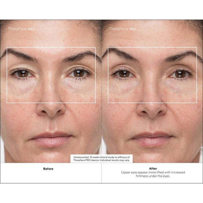 Coffret cadeau Therabody TF02226-01 Noir (1 Unité) 7