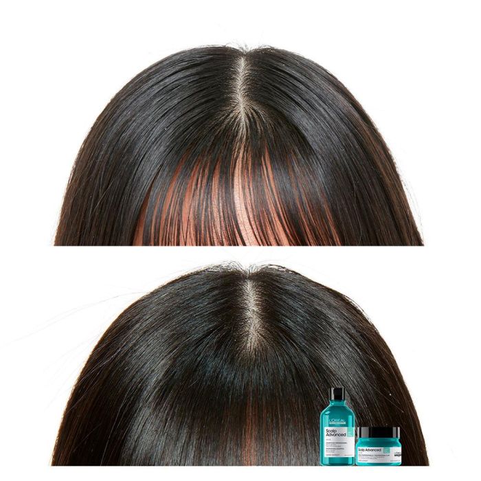 Scalp Advanced Champú 2