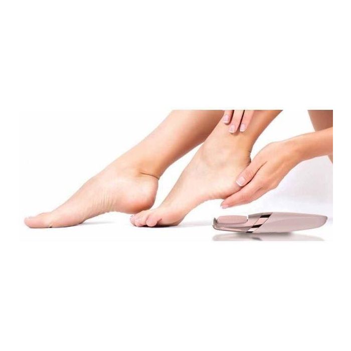 Finishing Touch Flawless Pedi - Escofina eléctrica recargable para pies - Removedor de callos - Experiencia de pedicura en el hogar 5 Finishing Touch Flawless Pedi - Escofina eléctrica recargable para pies - Removedor de callos - Experiencia de pedicura en el hogar 5