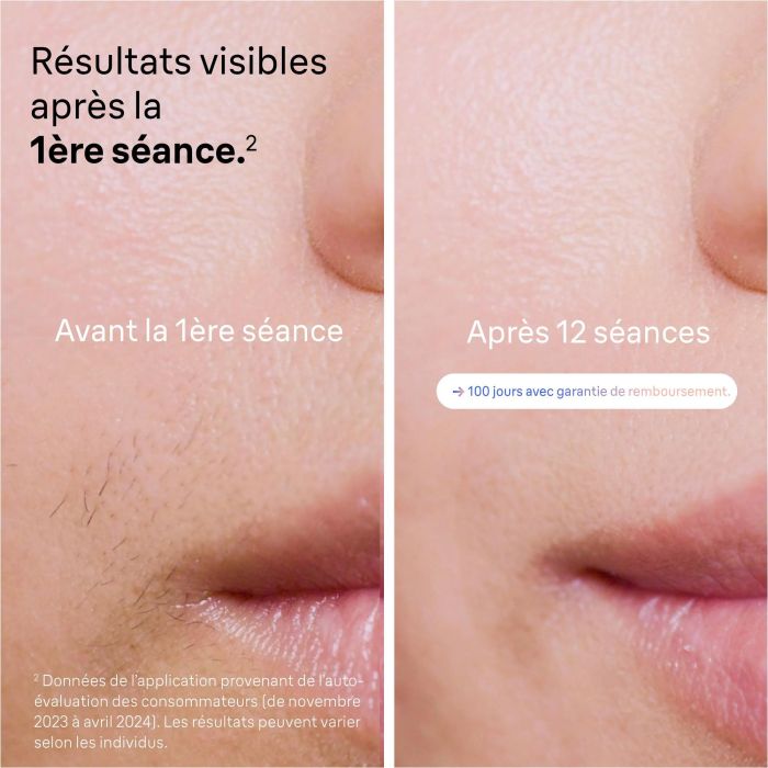 Braun Depiladora de Luz Pulsada IPL PL7253, 400.000 Destellos, Oro Rosa / Blanco