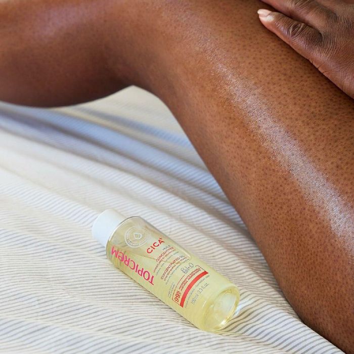 Topicrem Aceite CICA Cicatrices y Estrías Prevención y Reducción Hidratante 24h No Graso Apto Embarazadas y Familia 100 ml 2