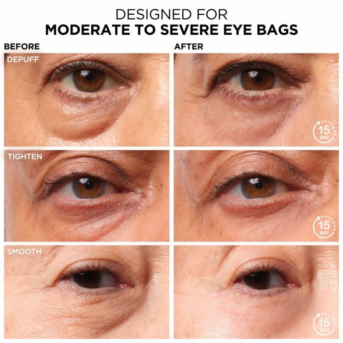 It Cosmetics BYE BYE under eye bags | Sérum Anti-Ojeras y Bolsas de Ojos con Efecto Lifting Temporal para Piel Sensible 15 ml 9 It Cosmetics BYE BYE under eye bags | Sérum Anti-Ojeras y Bolsas de Ojos con Efecto Lifting Temporal para Piel Sensible 15 ml 9