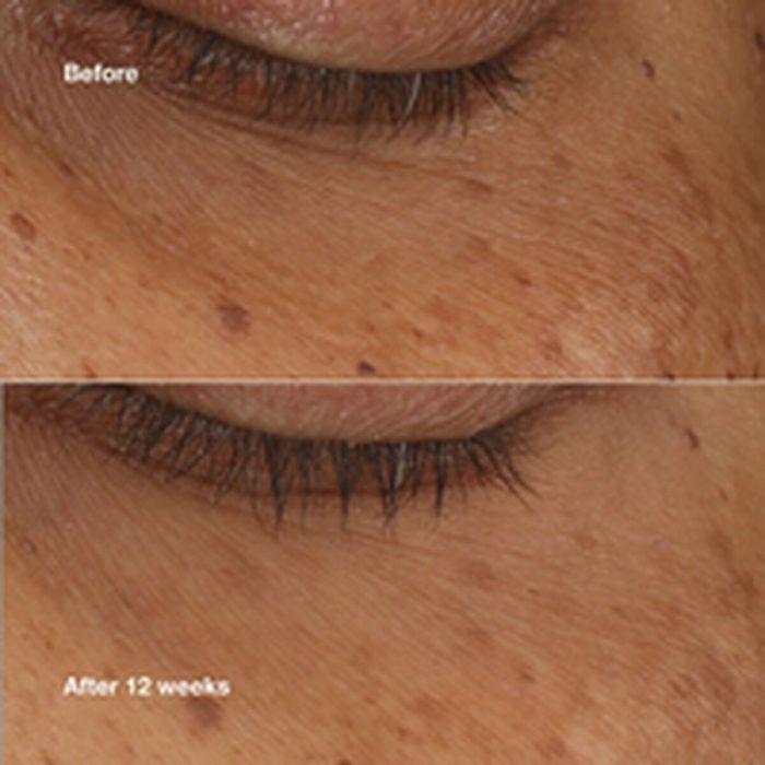 Clinique ALL ABOUT EYES Sérum Iluminador Concentrado 10 ml - Revitaliza y Ilumina el Contorno de Ojos 3