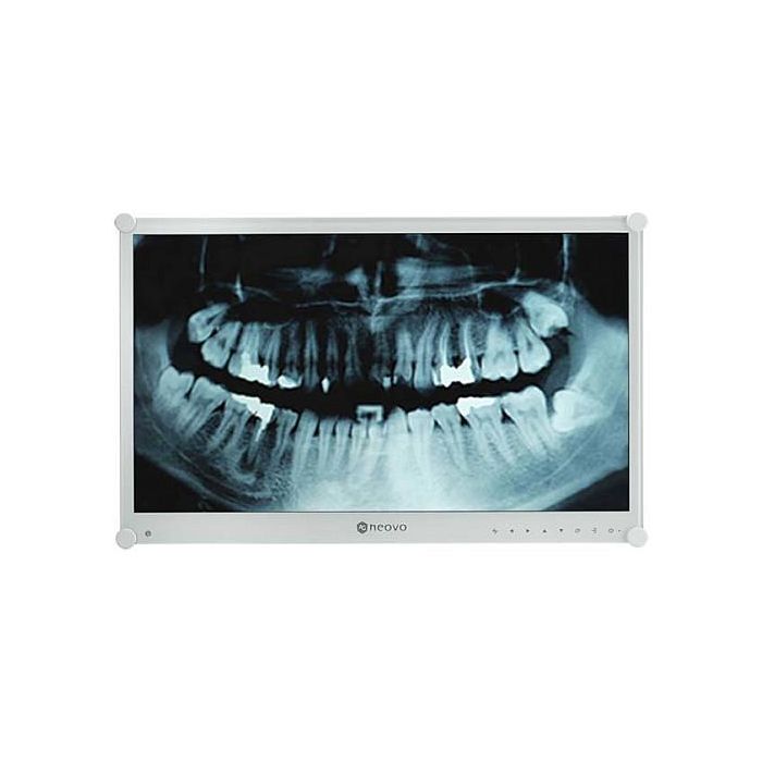 AG Neovo DR-24G Monitor Dental 23.8" Full HD LCD Blanco para Uso Médico 3