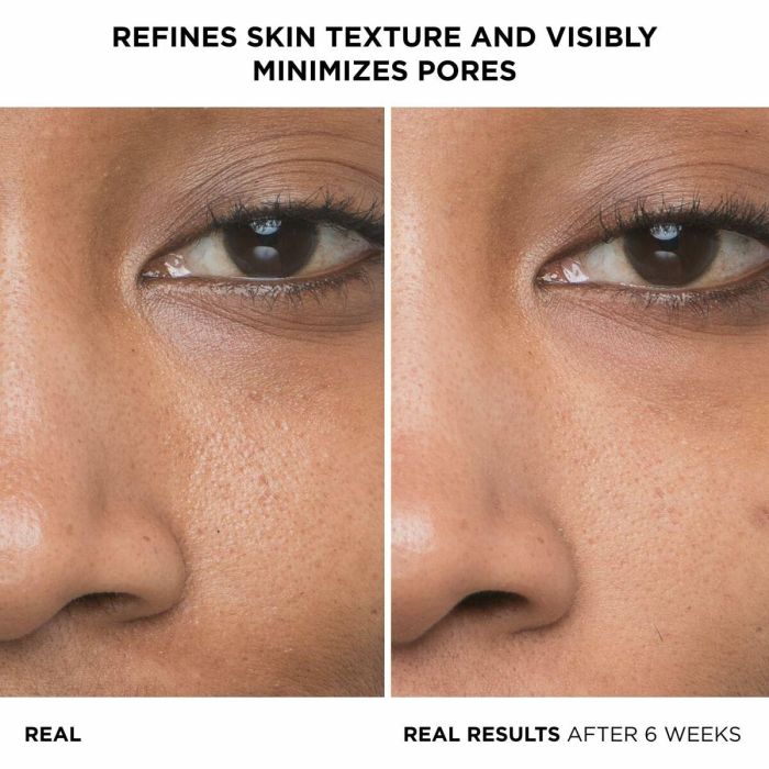 It Cosmetics F.I.L. D273373/1 BYE BYE PORES Sérum con 10% Ácido Glicólico + Hialurónico. Tratamiento Reductor de Poros, Acné y Puntos Negros 30 ml 5