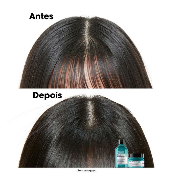 L'Oreal Scalp Advanced Champú para Cuero Cabelludo Graso 300ml 2