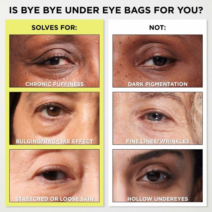 It Cosmetics BYE BYE under eye bags | Sérum Anti-Ojeras y Bolsas de Ojos con Efecto Lifting Temporal para Piel Sensible 15 ml 7 It Cosmetics BYE BYE under eye bags | Sérum Anti-Ojeras y Bolsas de Ojos con Efecto Lifting Temporal para Piel Sensible 15 ml 7