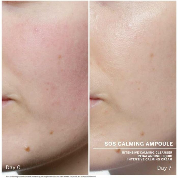 Tratamiento Facial Babor Sos Calming 6 Tratamiento Facial Babor Sos Calming 6