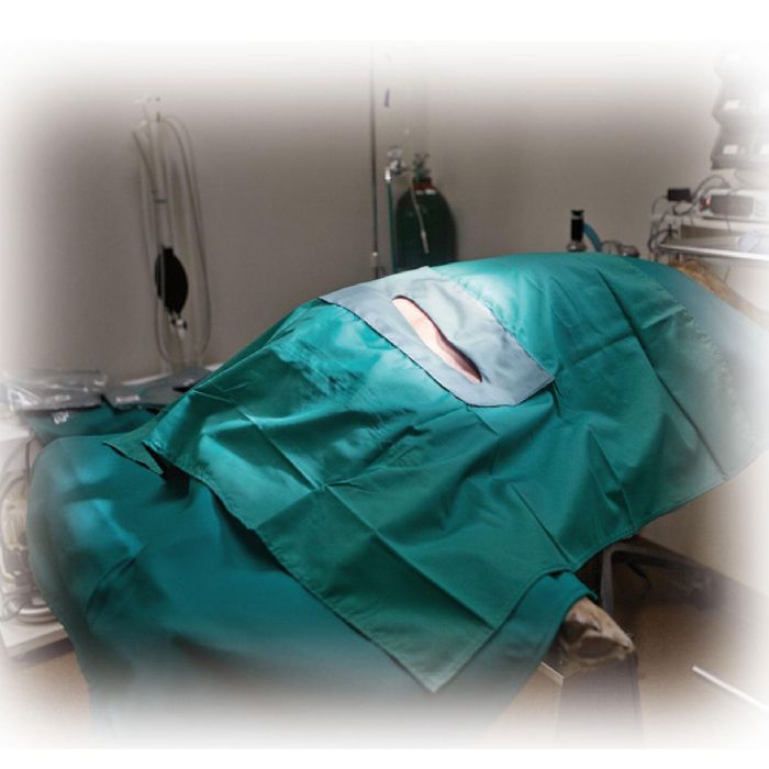 KVP Campo de Cirugía 75x75 cm con Ventana 17x3 cm Verde Lavable Autoclavable Barrera de Humedad Algodón Poliéster