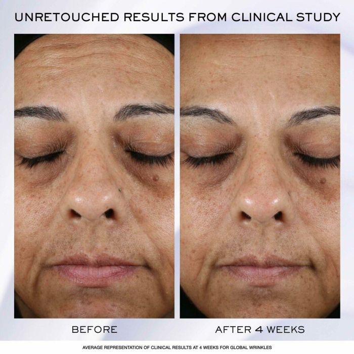 Lancôme Rénergie H.P.N 300-peptide Crema Anti-Edad 50 ml - Firmeza, Reducción de Arrugas y Tono Uniforme 5