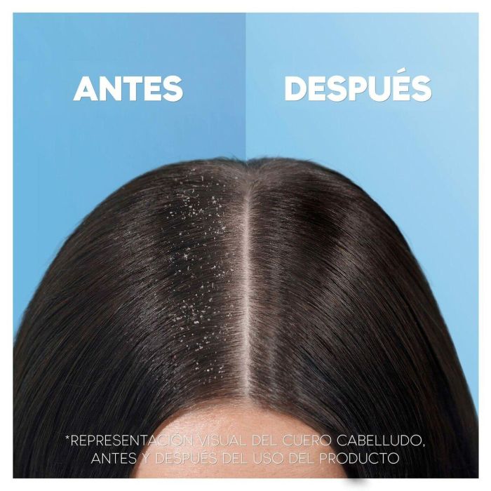 Head & Shoulders H&S Menthol Refresh Champú 5 Head & Shoulders H&S Menthol Refresh Champú 5