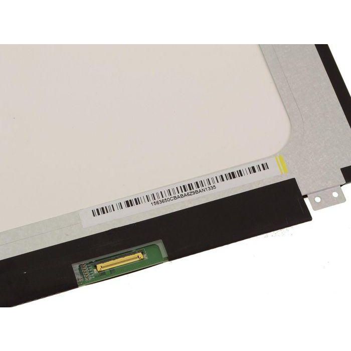 Dell EDP1.2 Pantalla LCD No Táctil 15.6 Pulgadas Full HD Antirreflejos 3