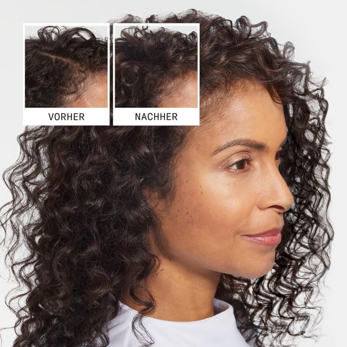 Champú Anticaída Nioxin Anti-Hairloss 475 ml 4