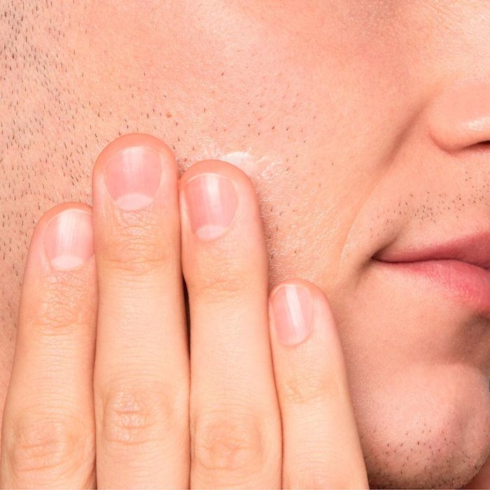 Kiehl'S Ultimate Razor Burn And Bump Relief 75 mL 3 Kiehl'S Ultimate Razor Burn And Bump Relief 75 mL 3