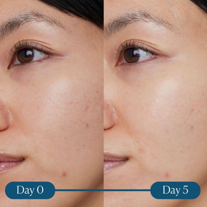 Elemis Dynamic Resurfacing Super-C Serum 3 Elemis Dynamic Resurfacing Super-C Serum 3