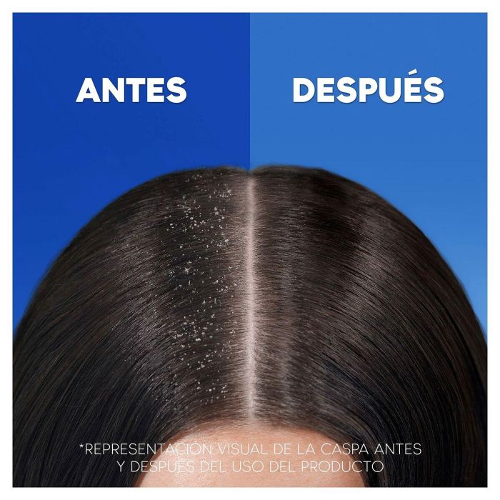 Head & Shoulders H&S Hairfall Defense Shampoo 6 Head & Shoulders H&S Hairfall Defense Shampoo 6