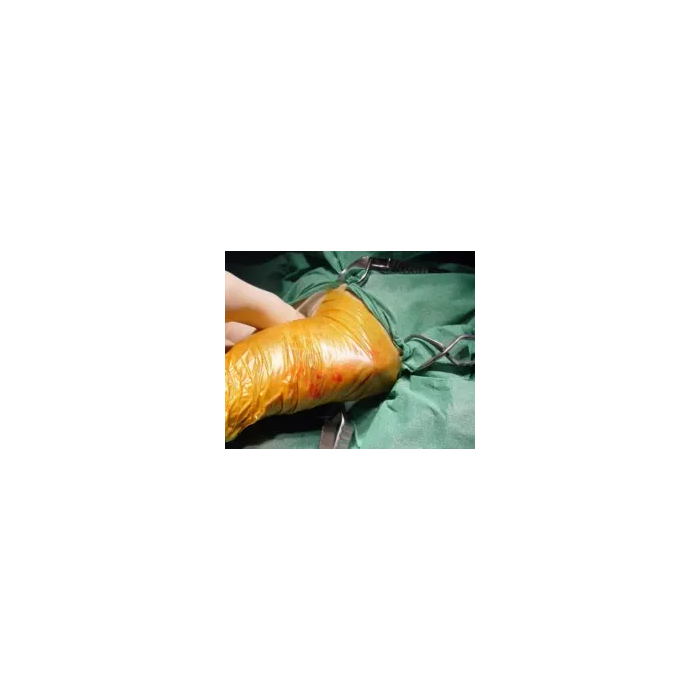 3M Campo Incision Ioban 2 56x60 cm 10 Unidades Caja
