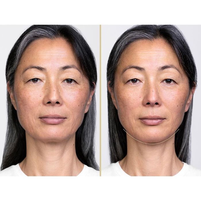 Shiseido Liftdefine Rad Night Conce 40 mL