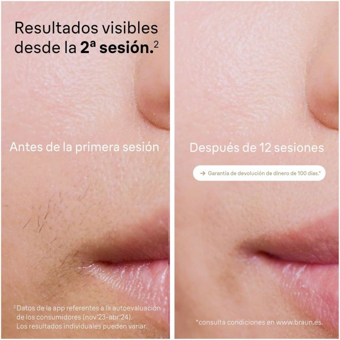 Depiladora Eléctrica Braun PL5382