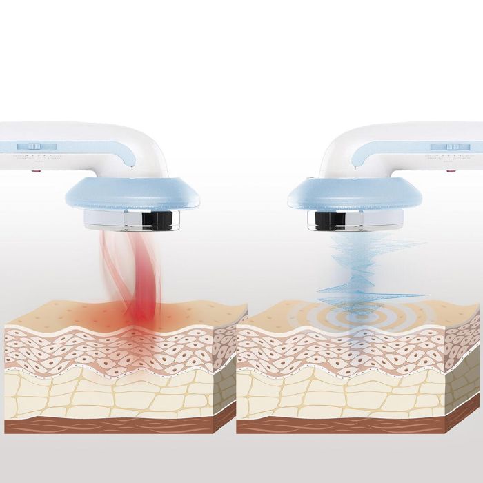 Masajeador Anticelulítico de Cavitación Ultrasónica con Infrarrojos y Electroestimulación 3 en 1 CellyMax InnovaGoods 5