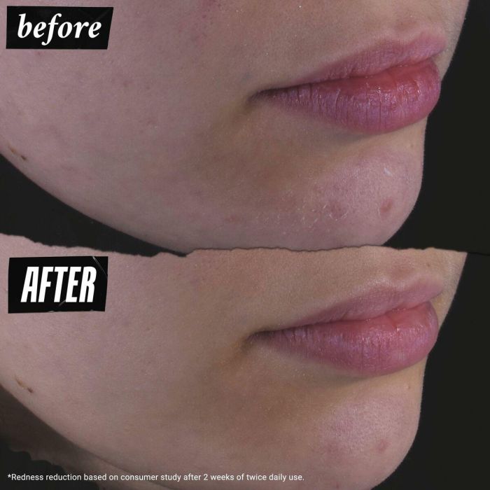 Gel Limpiador Facial Kiehl's CALENDULA 3