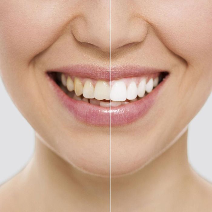 Tiras Blanqueadoras Dentales Wripes InnovaGoods 2 Tiras Blanqueadoras Dentales Wripes InnovaGoods 2