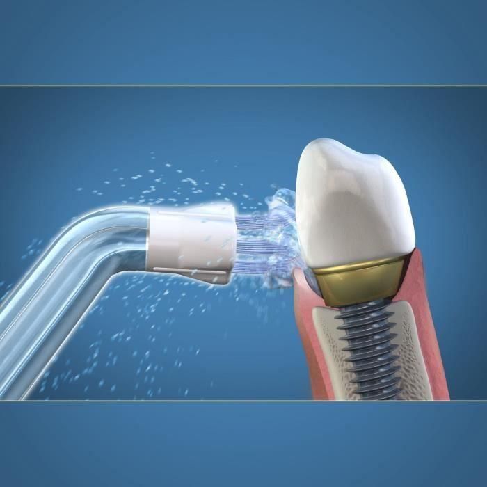 Waterpik Irrigador Boquilla Seeker Placa Inaccesible 1 Waterpik Irrigador Boquilla Seeker Placa Inaccesible 1