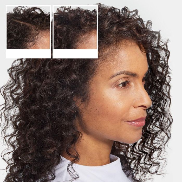 NIOXIN Champú Anticaída para Cabello Denso y Volumen 240 ml 3 NIOXIN Champú Anticaída para Cabello Denso y Volumen 240 ml 3