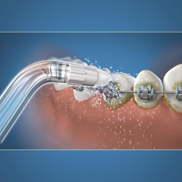 Punta irrigador dental - WATERPIK - Ortodoncia - Elimina placa - Aparatos dentales especiales 1 Punta irrigador dental - WATERPIK - Ortodoncia - Elimina placa - Aparatos dentales especiales 1