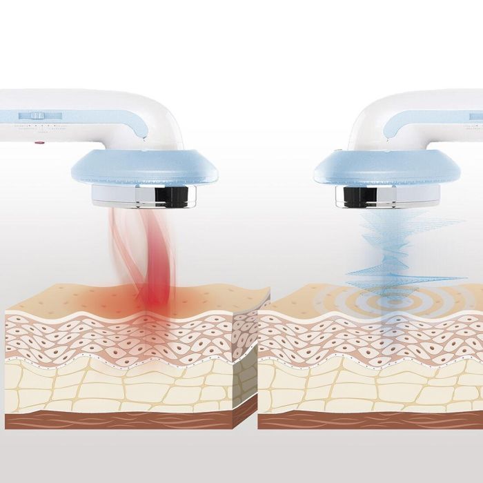 Masajeador Anticelulítico de Cavitación Ultrasónica con Infrarrojos y Electroestimulación 3 en 1 CellyMax InnovaGoods 5 Masajeador Anticelulítico de Cavitación Ultrasónica con Infrarrojos y Electroestimulación 3 en 1 CellyMax InnovaGoods 5