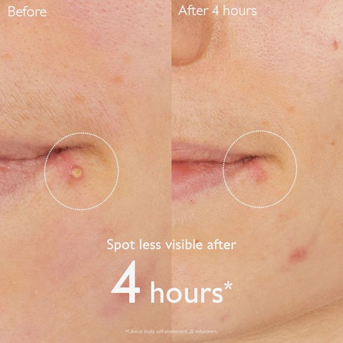 Caudalie Vinopure Stop Granos Salicílico 2