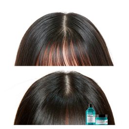 Scalp Advanced Champú