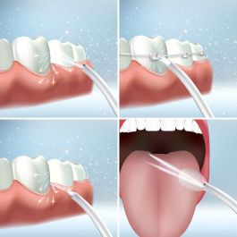 Irrigador Dental Recargable Portátil Denter InnovaGoods Irrigador Dental Recargable Portátil Denter InnovaGoods
