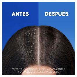 Champú Head & Shoulders S Anticaída 1 L