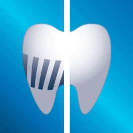 Philips Sonicare ProResults cabezales de cepillado sónico estándar 8 unidades blanco