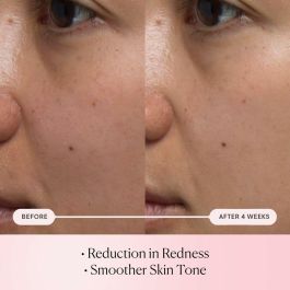 Elemis PRO-COLLAGEN Rose Micro Serum con Microperlas de Rosa Inglesa Orgánica. Sérum Antiedad, Reafirmante e Hidratante 72h. Piel Radiante 30 ml Elemis PRO-COLLAGEN Rose Micro Serum con Microperlas de Rosa Inglesa Orgánica. Sérum Antiedad, Reafirmante e Hidratante 72h. Piel Radiante 30 ml