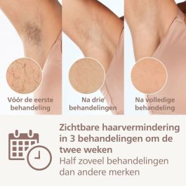 Depiladora Eléctrica de Luz Pulsada Philips BRI946/00 *