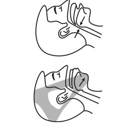 Inde Banda Antirronquidos Stosnore Innovagoods (21 Unidades)