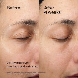 Shiseido Future Solution LX Crema Regeneradora Contorno de Ojos y Labios 17 ml