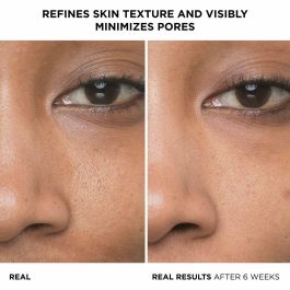 It Cosmetics F.I.L. D273373/1 BYE BYE PORES Sérum con 10% Ácido Glicólico + Hialurónico. Tratamiento Reductor de Poros, Acné y Puntos Negros 30 ml