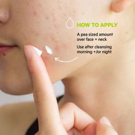 Tratamiento Antimanchas SVR 40 ml