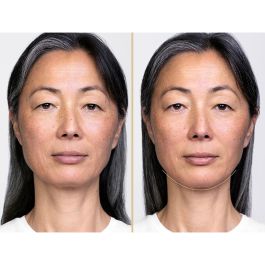 Shiseido VITAL PERFECTION lift define night serum 40 ml <M116963-712>